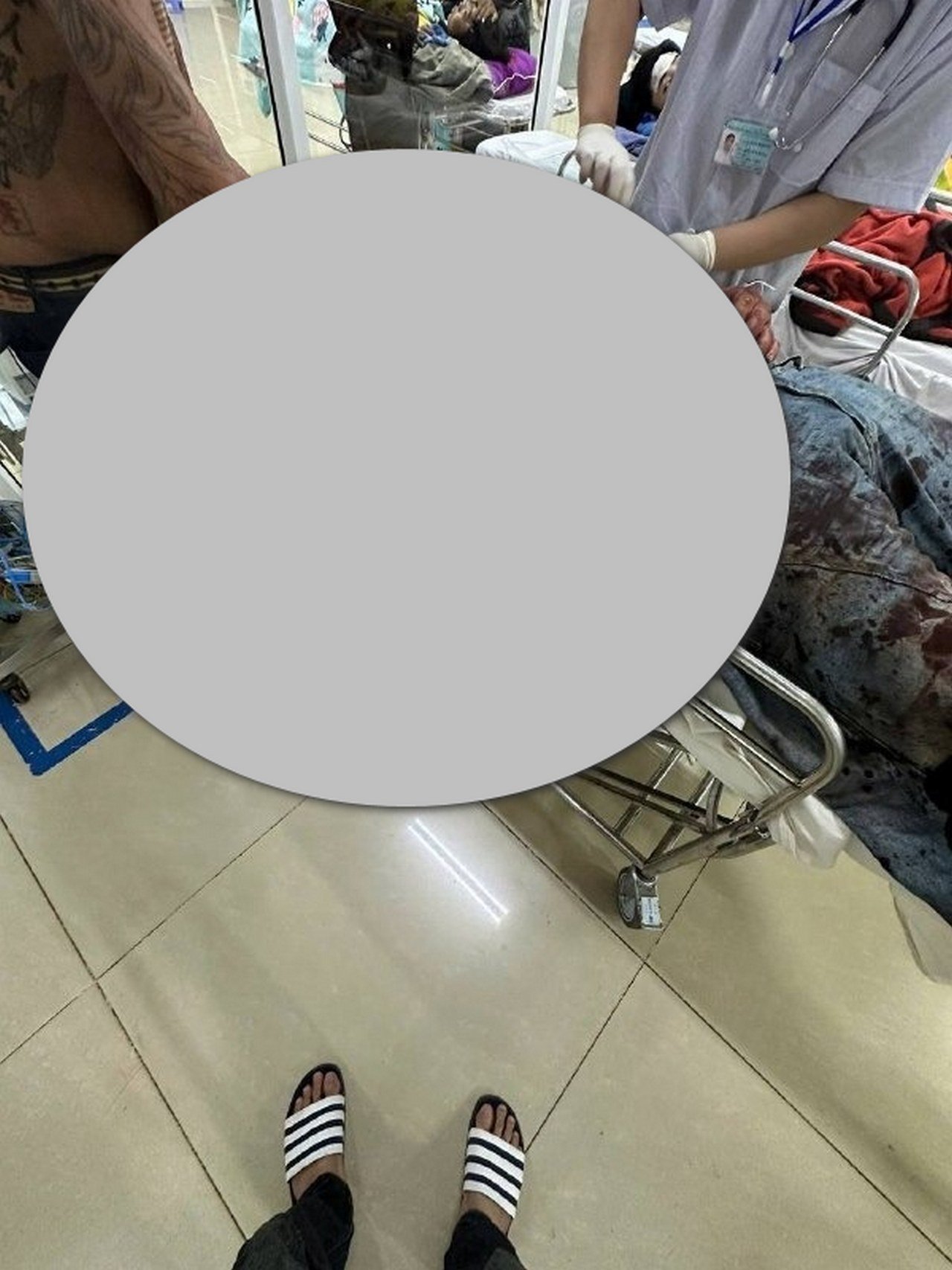 Nghe bảo bạn bè nhậu xong giỡn cke’m nhau mà hậu quả thấy căng thẳng